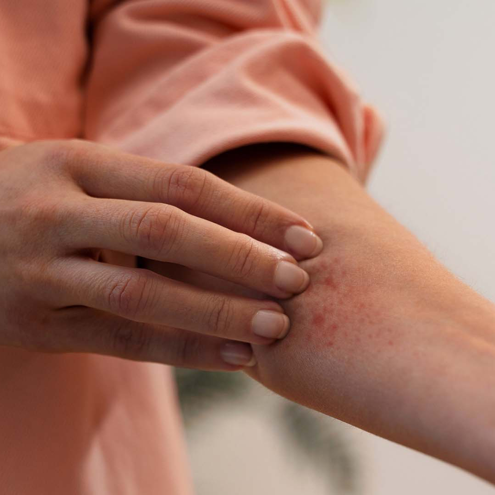 مرض بهجت التهاب نادر بأعراض متعددة