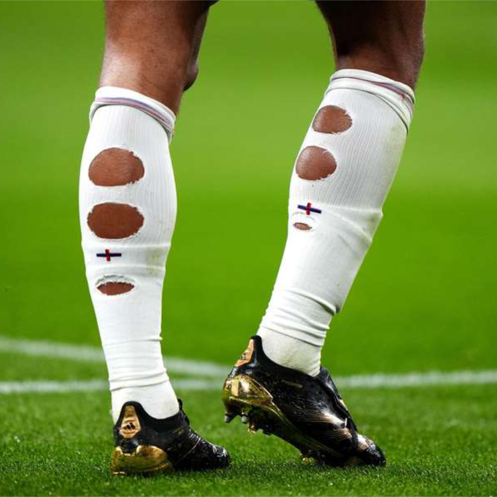 سر الجوارب الممزقة في الملاعب