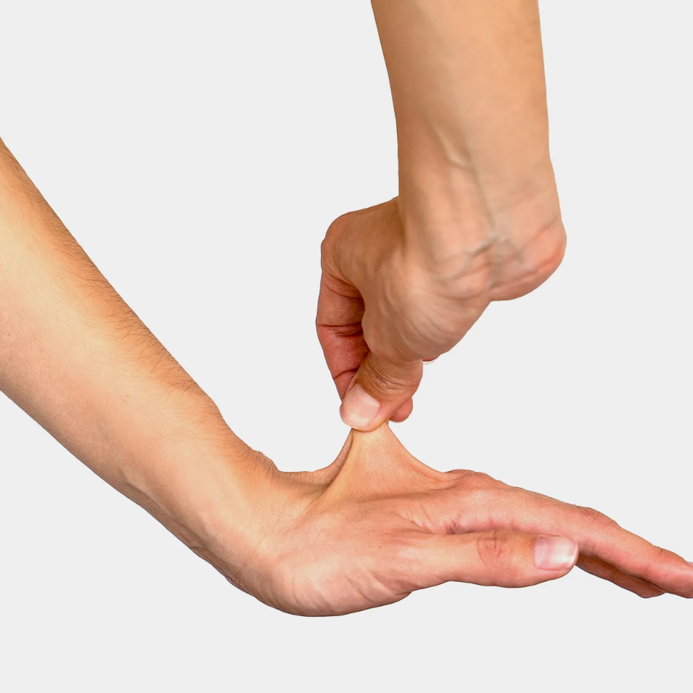 متلازمة إهلرز دانلوس